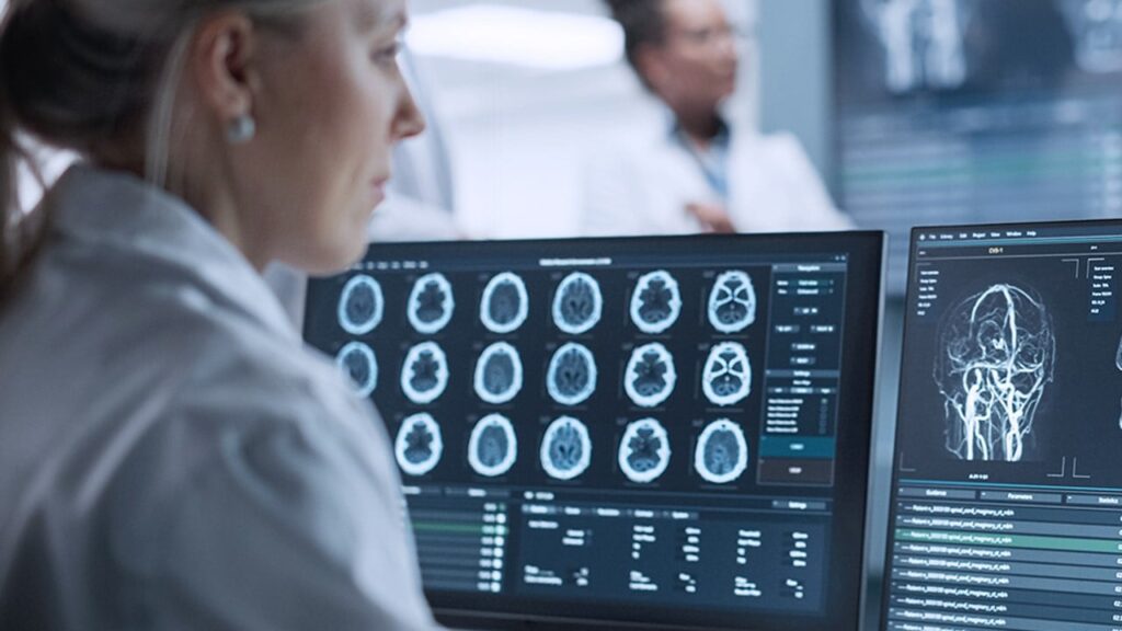 Чи може комп’ютерна томографія викликати рак – дослідження