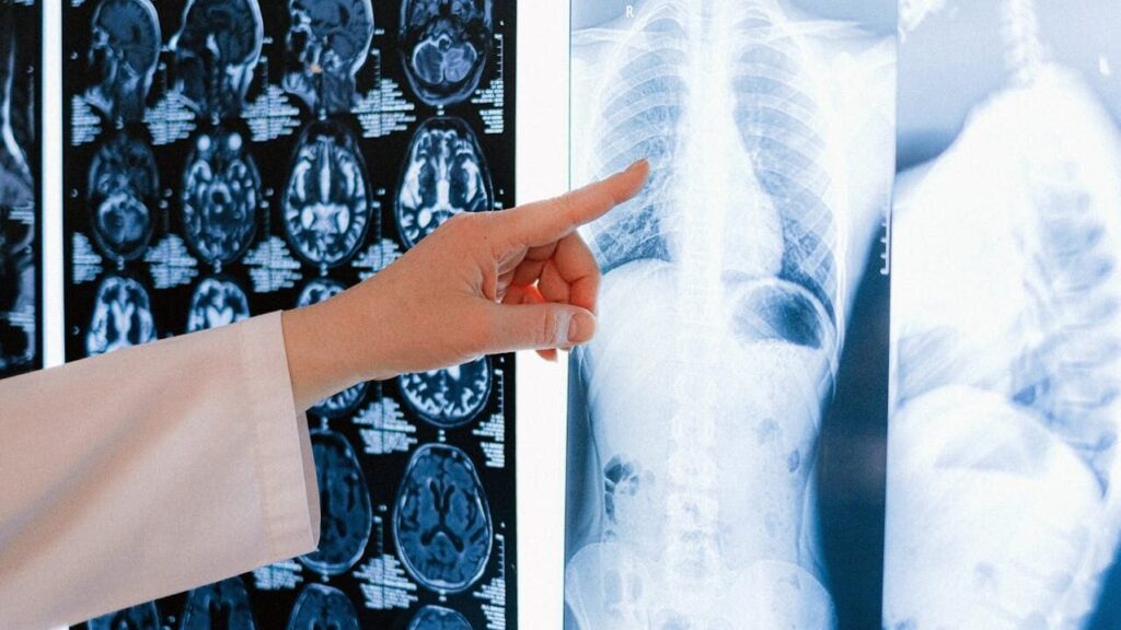 Для прифронтових регіонів: Франція передала Україні вісім рентгенсистем