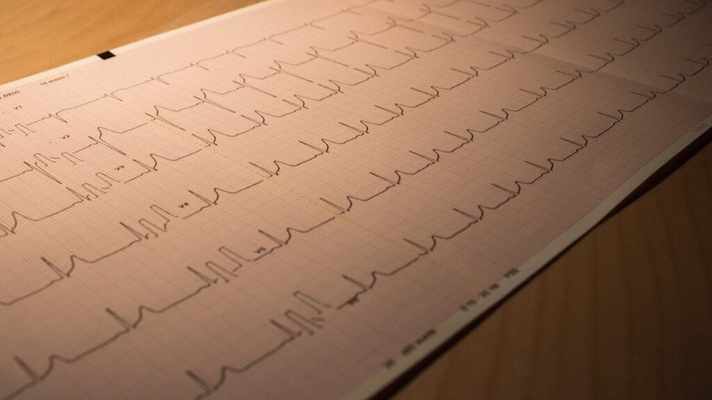 Стан небезпечний для життя: кардіологи назвали симптоми синдрому розбитого серця