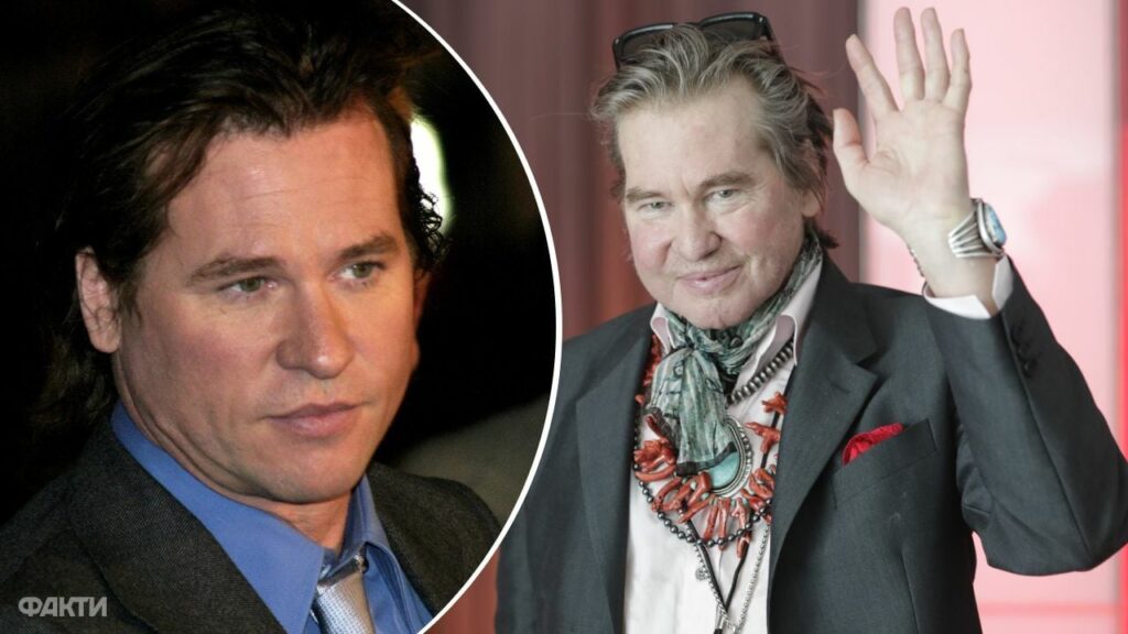 Рак повернувся: що стало причиною смерті Вела Кілмера