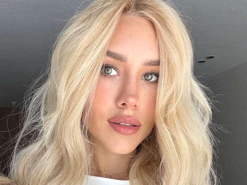 Квіткова показала обличчя із синцями