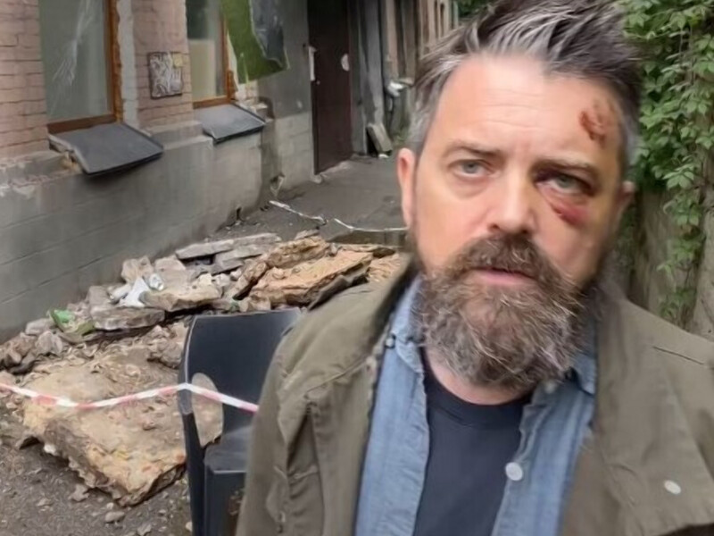 На режисера зі США Крістофера Волтерса, який знімав фільм про війну в Києві, упав балкон На режисера зі США Крістофера Волтерса, який знімав фільм про війну в Києві, упав балкон