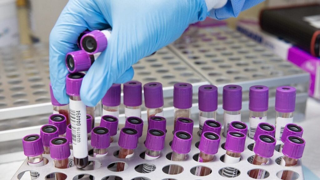 Через глобальне потепління Європі загрожує смертоносний грибок — дослідження