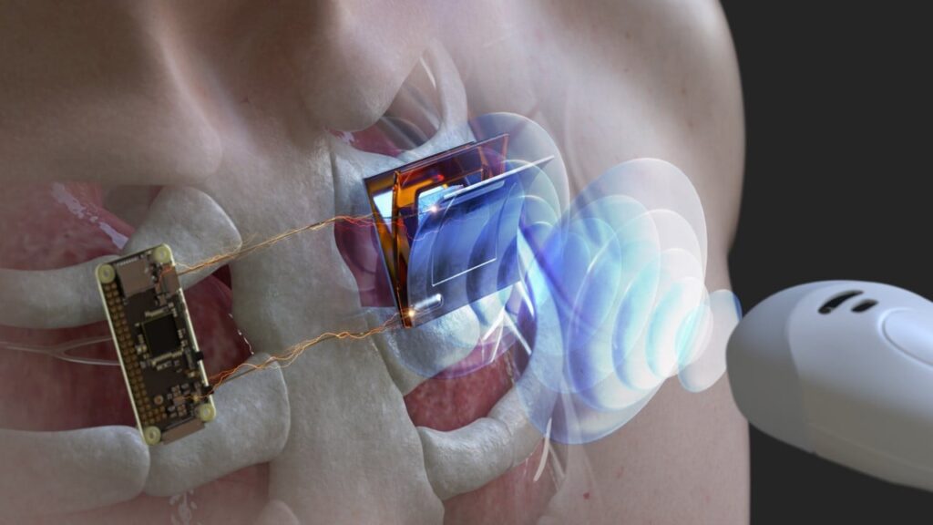 Ультразвук замість проводів: у Кореї розробили зарядку для імплантів і підводної техніки Ультразвук замість проводів: у Кореї розробили зарядку для імплантів і підводної техніки