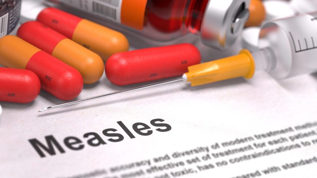 Америкою стрімко шириться вірус кору:  у США, Мексиці та Канаді понад 4 тис. випадків