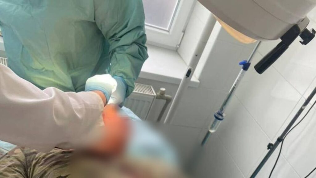 У Великому Березному на Закарпатті закидали камінням прикордонників: двоє у лікарні