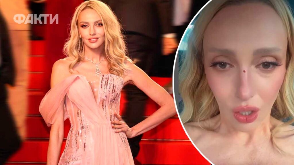 Розбила ніс: Полякова потрапила в аварію перед Каннським кінофестивалем