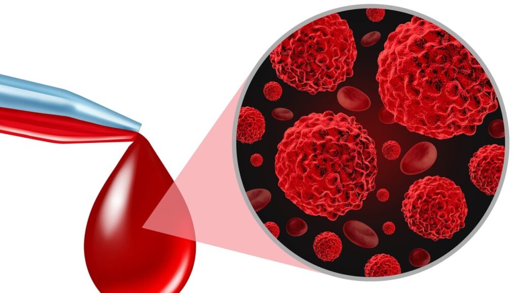 Створено інноваційний аналіз крові для ранньої діагностики хвороби Альцгеймера