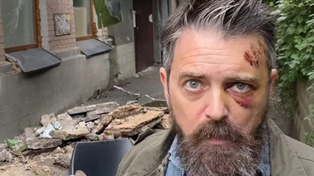 У Києві обвалився балкон із американцем, який знімав війну в Україні