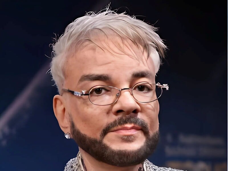 "Став кволий". Колега Кіркорова зробив заяву про стан обгорілого артиста "Став кволий". Колега Кіркорова зробив заяву про стан обгорілого артиста