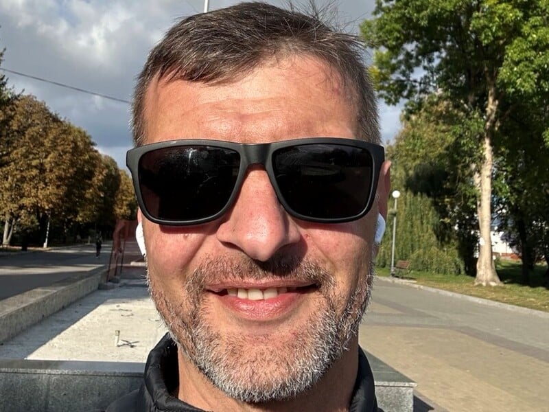 Морпіх Діанов показав, як за кілька років регулярних тренувань відновив поранену руку. Фото Морпіх Діанов показав, як за кілька років регулярних тренувань відновив поранену руку. Фото