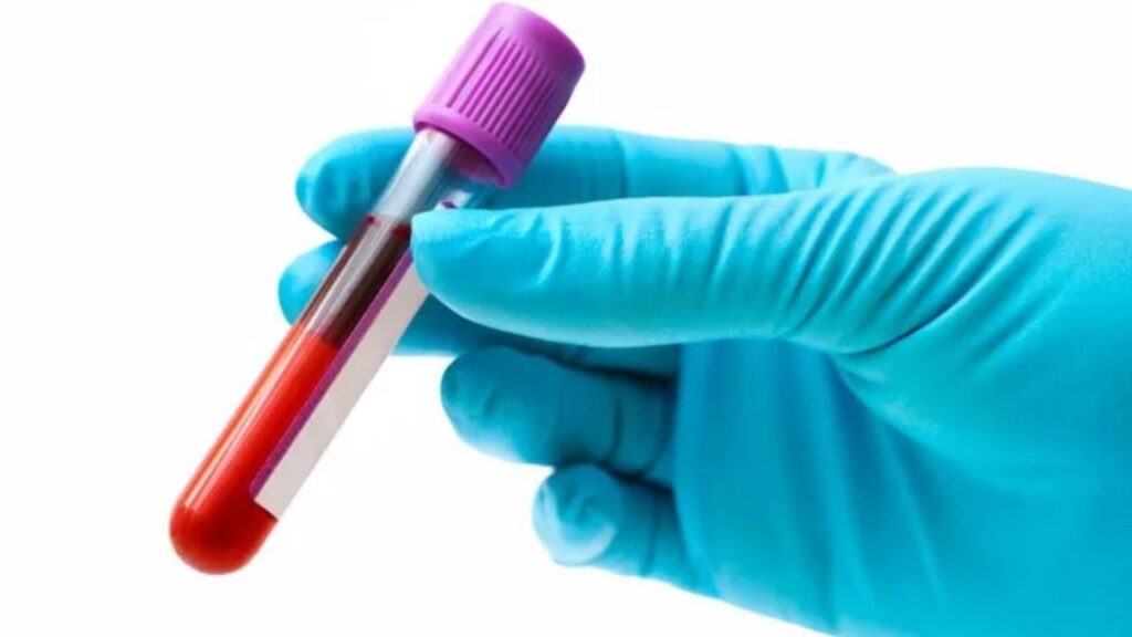 Центри донорської крові працюватимуть за новими правилами: що змінилося