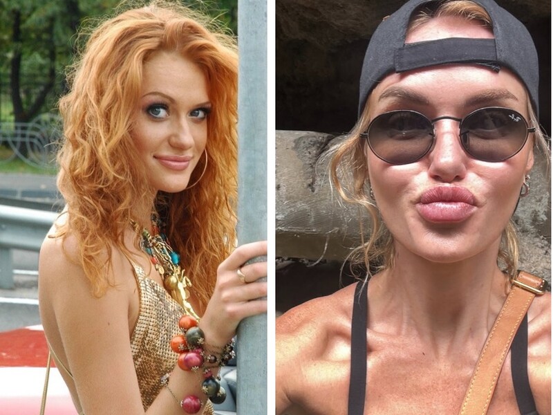 Який вигляд мала Камінська з "НеАнгелів" до пластичних операцій і який – після