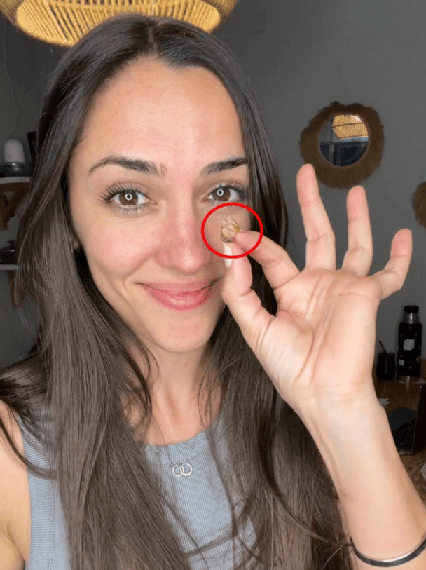 Могла залишитися ще з пологового: у носі жінки виявили несподівану знахідку