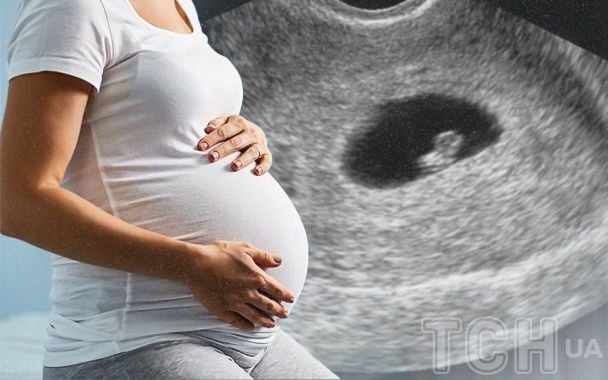 Чи гріх робити аборт у випадках соціальної або матеріальної скрути: священник Філюк пояснив