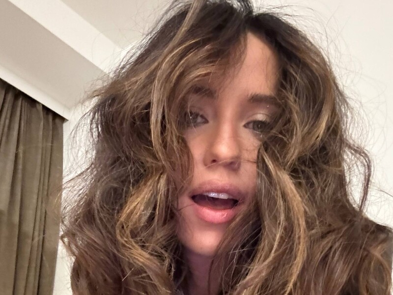 "Надь, будь обережна", "Жесть". Дорофєєва крупним планом показала синці в несподіваних місцях