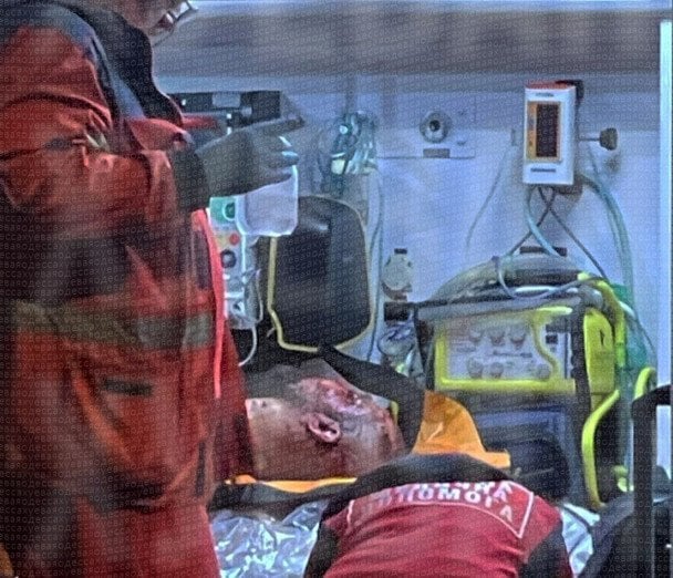 Вибух в Одесі: чоловік підрвав гранати у під’їзді