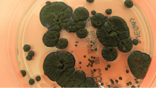 Грибок-"пожирач" радіації з Чорнобиля може захистити астронавтів у космосі: деталі