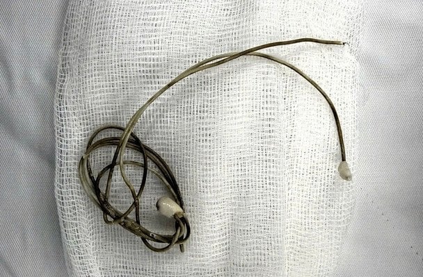 Підліток встромив у пеніс зарядний кабель: чим це закінчилося (фото)