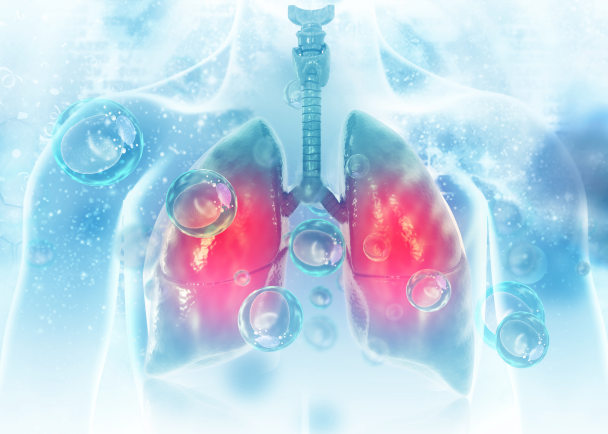 Пневмонія: як розпізнати хворобу, хто у групі ризику