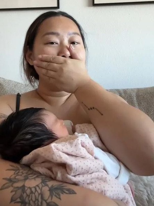 Жінка після пологів виявила третю грудь із соском у несподіваному місці — фото, відео