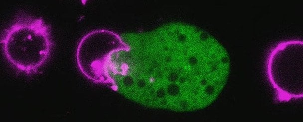 Вчені б’ють на сполох: амеби, що пожирають мозок стають глобальною загрозою