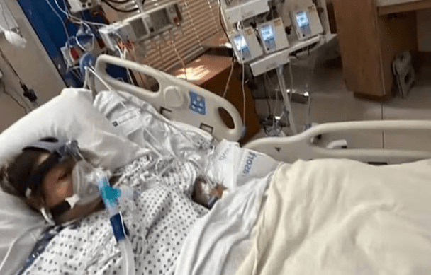 Жінка втратила всі кінцівки після вживання недосмаженої риби: що сталося