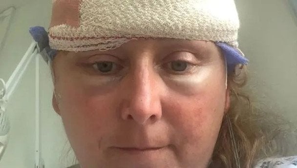 Жінка списувала симптоми на менопаузу, але лікарі виявили 10 пухлин мозку