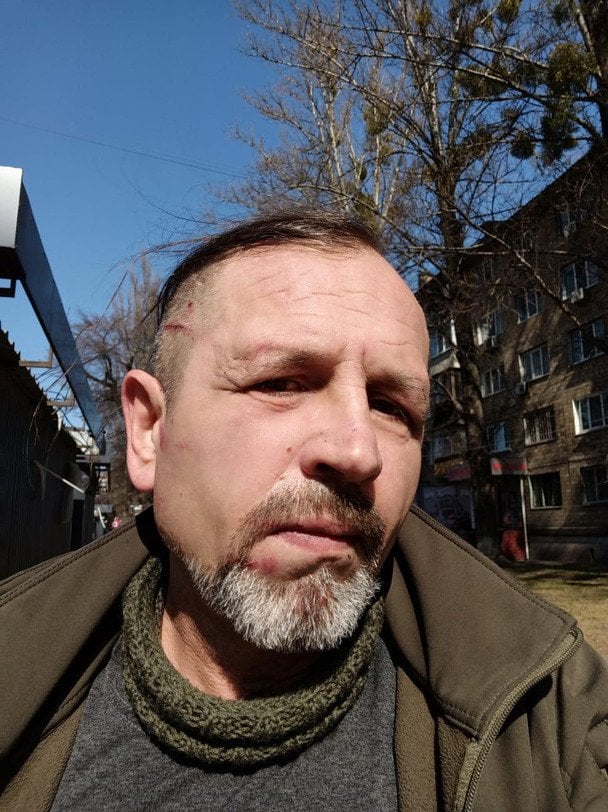 У Києві побили колишнього політв’язня Володимира Балуха: усі подробиці від потерпілого та ТЦК