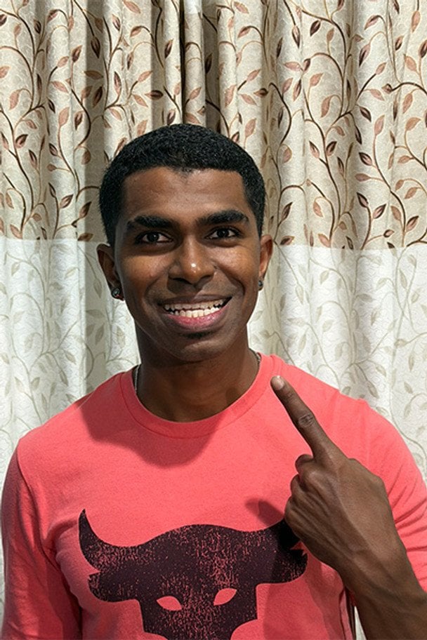 Чоловік із найбільшою кількістю зубів у світі показав свою унікальну усмішку — фото