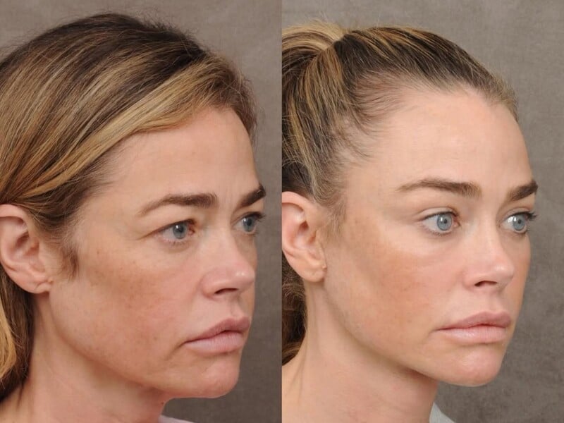 Одна з найгарніших акторок у світі зробила підтяжку обличчя. Фото до й після