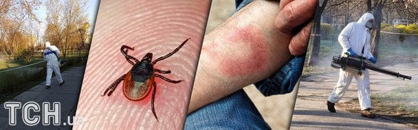 Київ атакує хвороба Лайма: які симптоми і як не допустити менінгіт
