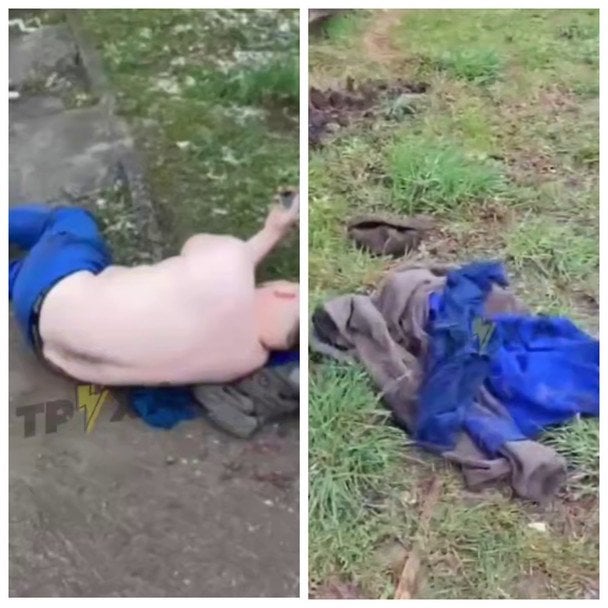 Скандал з ТЦК у Тернополі: чоловік з переломом, поліція відкрила провадження (відео)