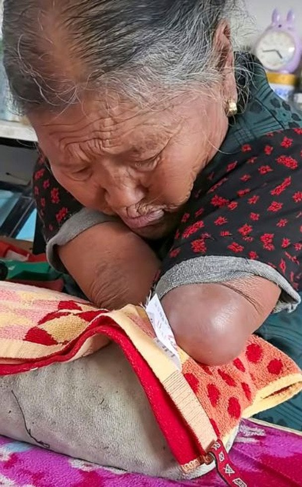 Жінка без кінцівок шила ротом і виростила трьох дітей — фото