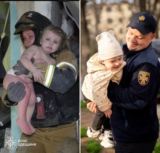 Погляд, що зворушив Україну: історія порятунку 2-річної одеситки, яка вижила під ударом РФ