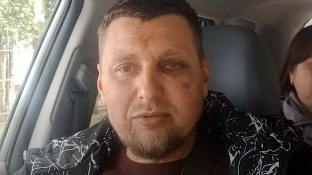 "За що я воював?": у Луцьку ветеран з інвалідністю заявляє про побиття військовими ТЦК