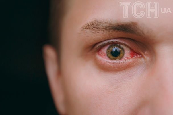 Чоловік дістав тяжкі травми очей після використання масажного пістолета