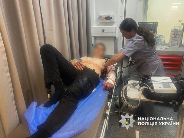 Кривавий обшук у Запоріжжі: чоловік порізав трьох поліцейських, його застрелили
