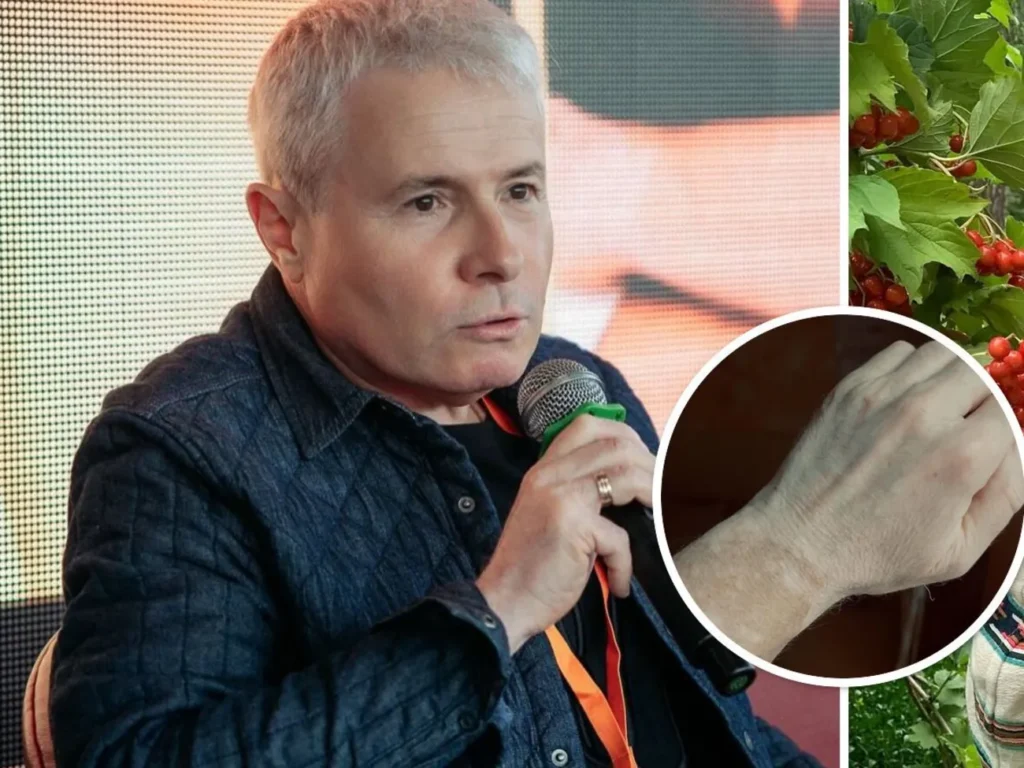 Відомий ведучий розповів про свою невиліковну хворобу: Це не заважає жити, любити, мріяти