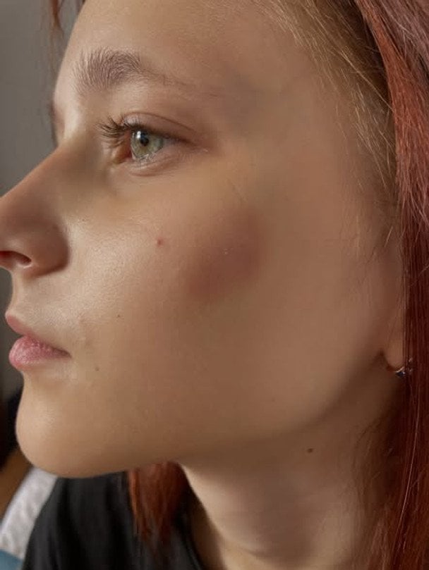 "Бо ви з України": у Польщі жінка побила дітей кулаком в шию та в обличчя — деталі від поліції "Бо ви з України": у Польщі жінка побила дітей кулаком в шию та в обличчя — деталі від поліції