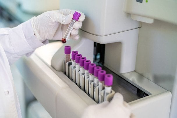 Мікропластик виявили у всіх досліджених артеріях — вчені б’ють на сполох