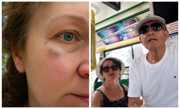 "Навіщо вас захищати?": військовий стверджує, що його маму побили за російську мову на Львівщині (відео)