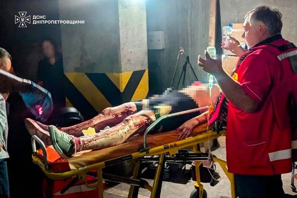 У Кривому Розі 63 постраждалих залишаються в лікарнях: 29 — у важкому стані