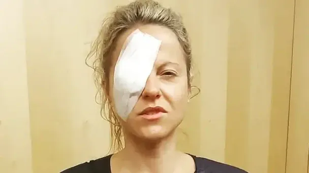 Думала, що просто втомилися очі: "мерехтіння" привело жінку до страшного діагнозу