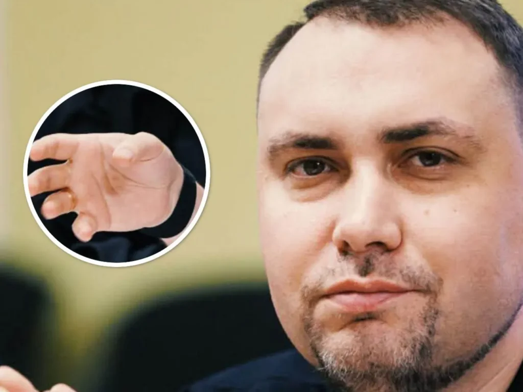 "Втомився засмучуватись". 40-річний Буданов розповів про стан свого здоров'я "Втомився засмучуватись". 40-річний Буданов розповів про стан свого здоров'я